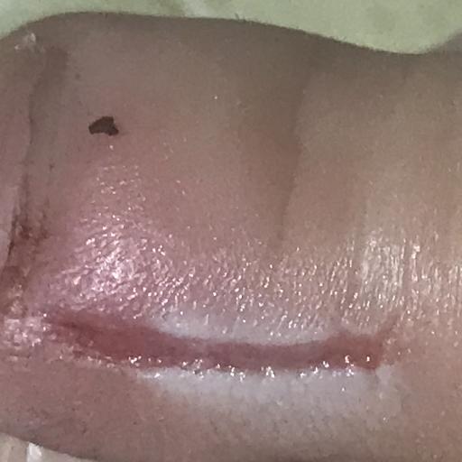ToeStrips