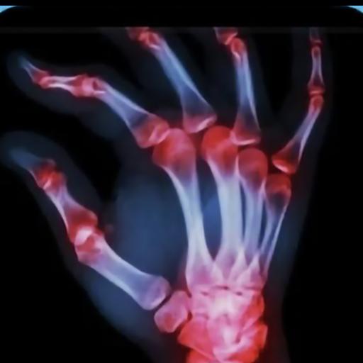 carpaltunnelchaos